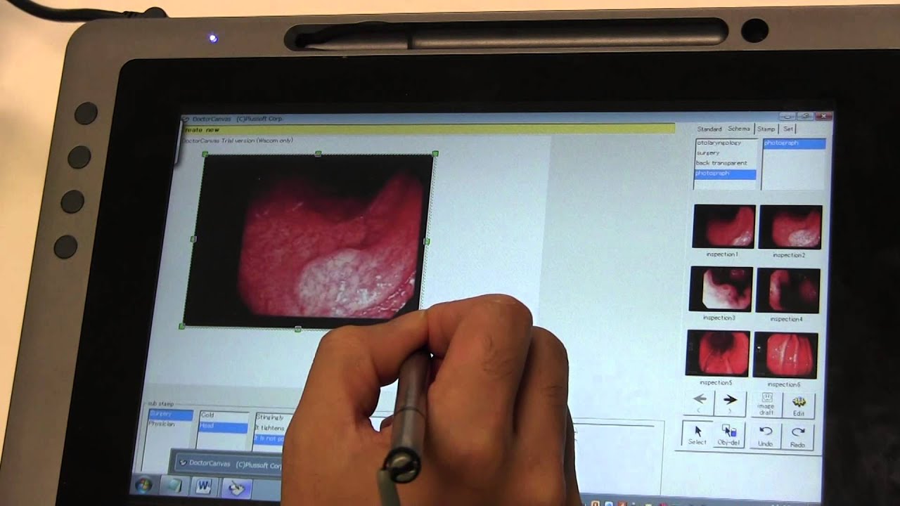 Wacom DTU-1031 with Dr Canvas (Medical)