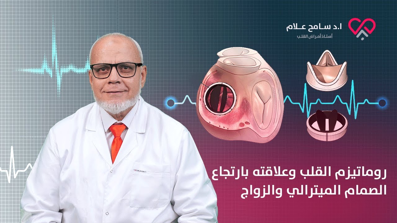 روماتيزم القلب وعلاقته بارتجاع الصمام الميترالي والزواج - دكتور سامح علام