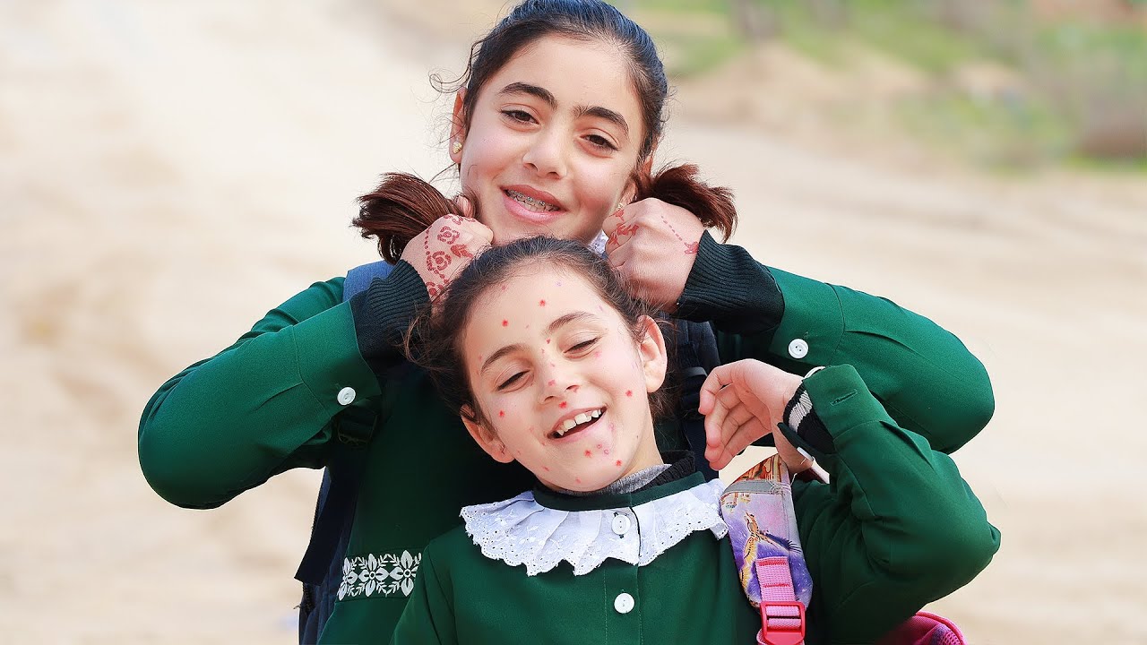 لما بنتك حساسية الجدري المائي ينتشر في جسمها وتبطل تروح المدرسة