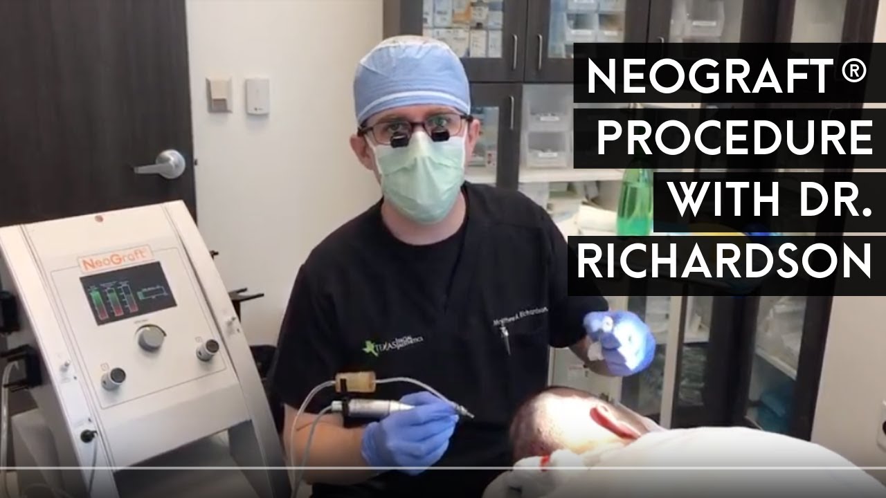 Neograft&reg; Procedure with Dr. Richardson
