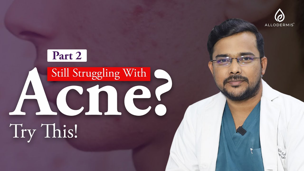 The Real Reason Your Acne Won’t Go Away | Dermatologist Explains |Allodermis   #draloksahoo