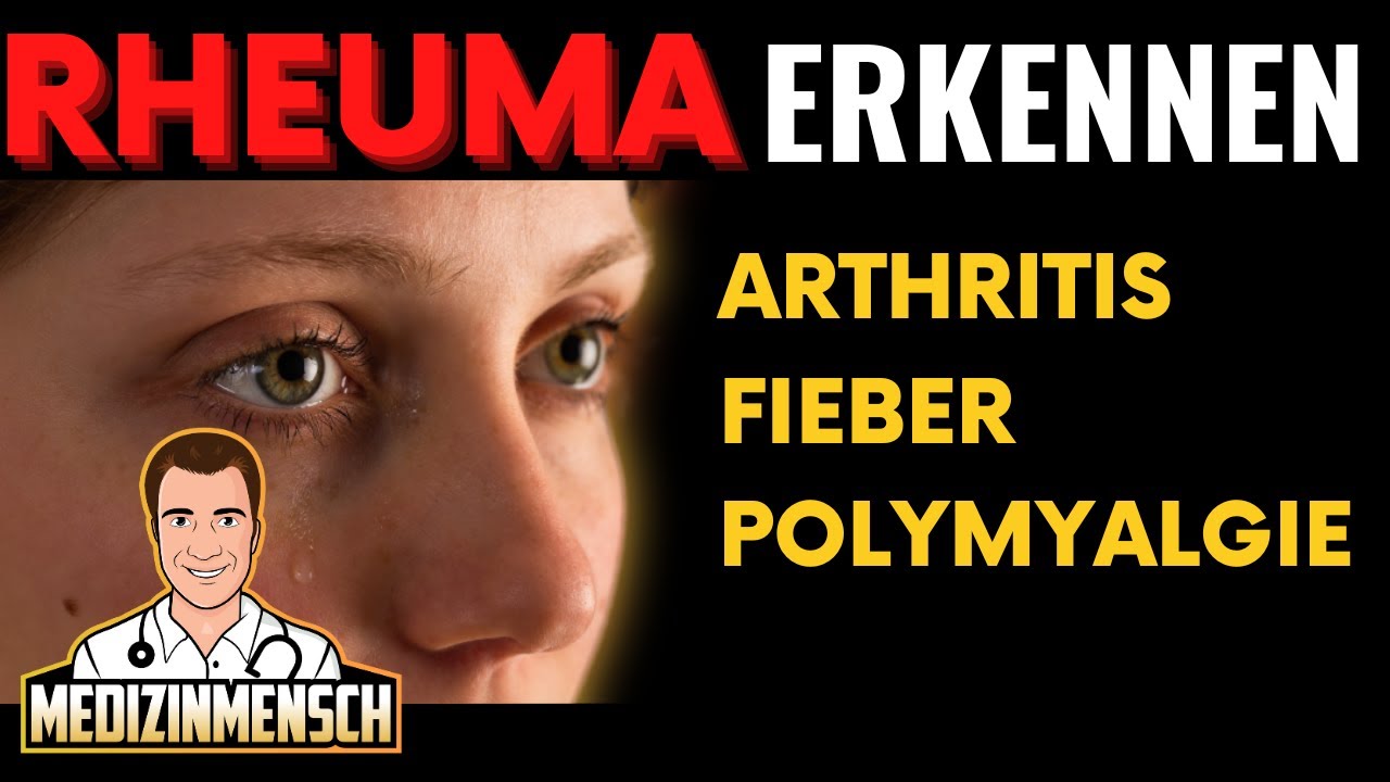 Rheuma: Symptome von Arthritis, Fieber, Polymyalgia Rheumatica (Rheumatologe erklärt)