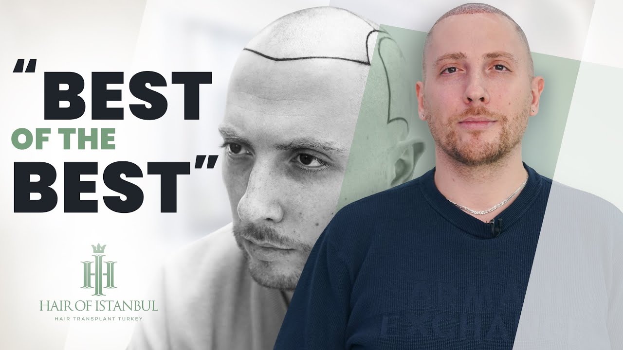 Filippo's Journey: Discovering Excellence at Hair of Istanbul