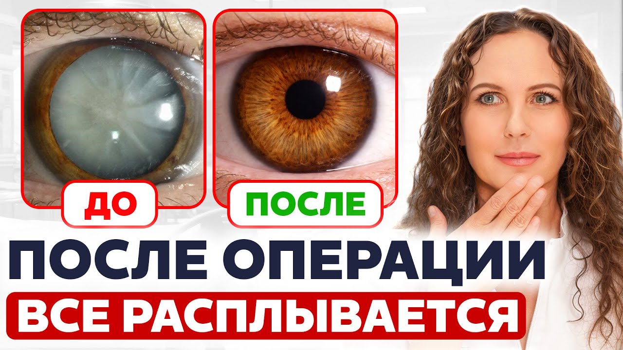 70% пациентов паникуют после операции катаракты! Что РЕАЛЬНО может пойти не так?