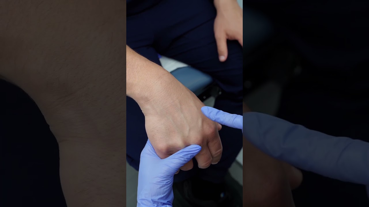 Common veins for IV insertion & blood draw: