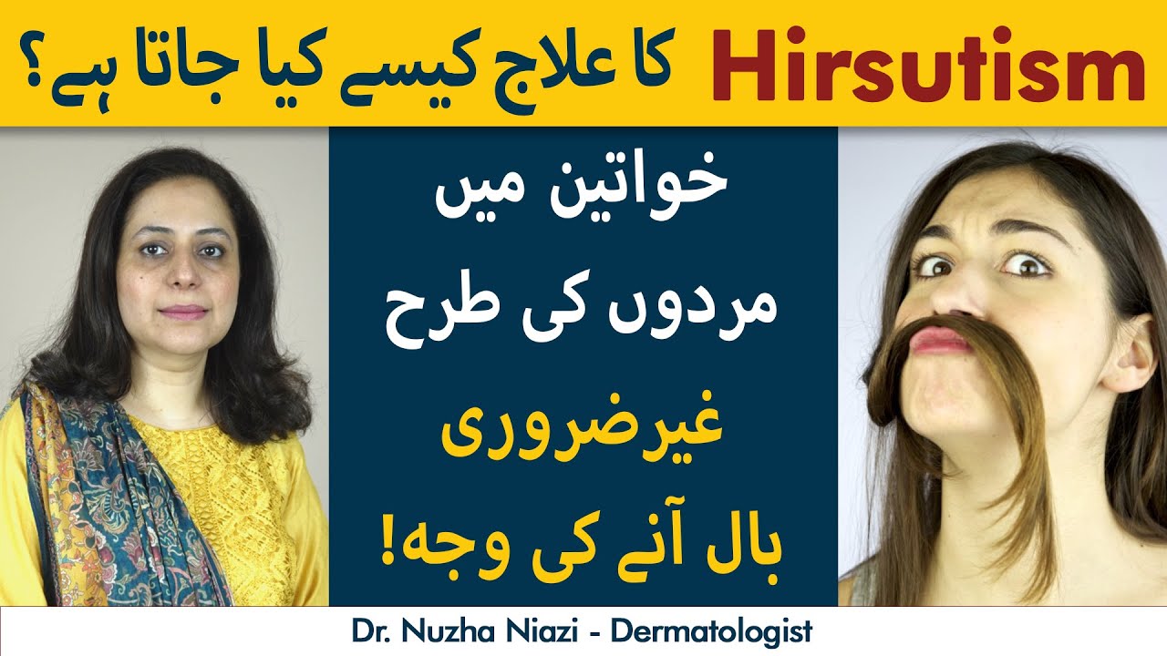 Hirsutism Kya Hai? | Unwanted Hair Growth in Women | Causes and Treatment of Hirsutism