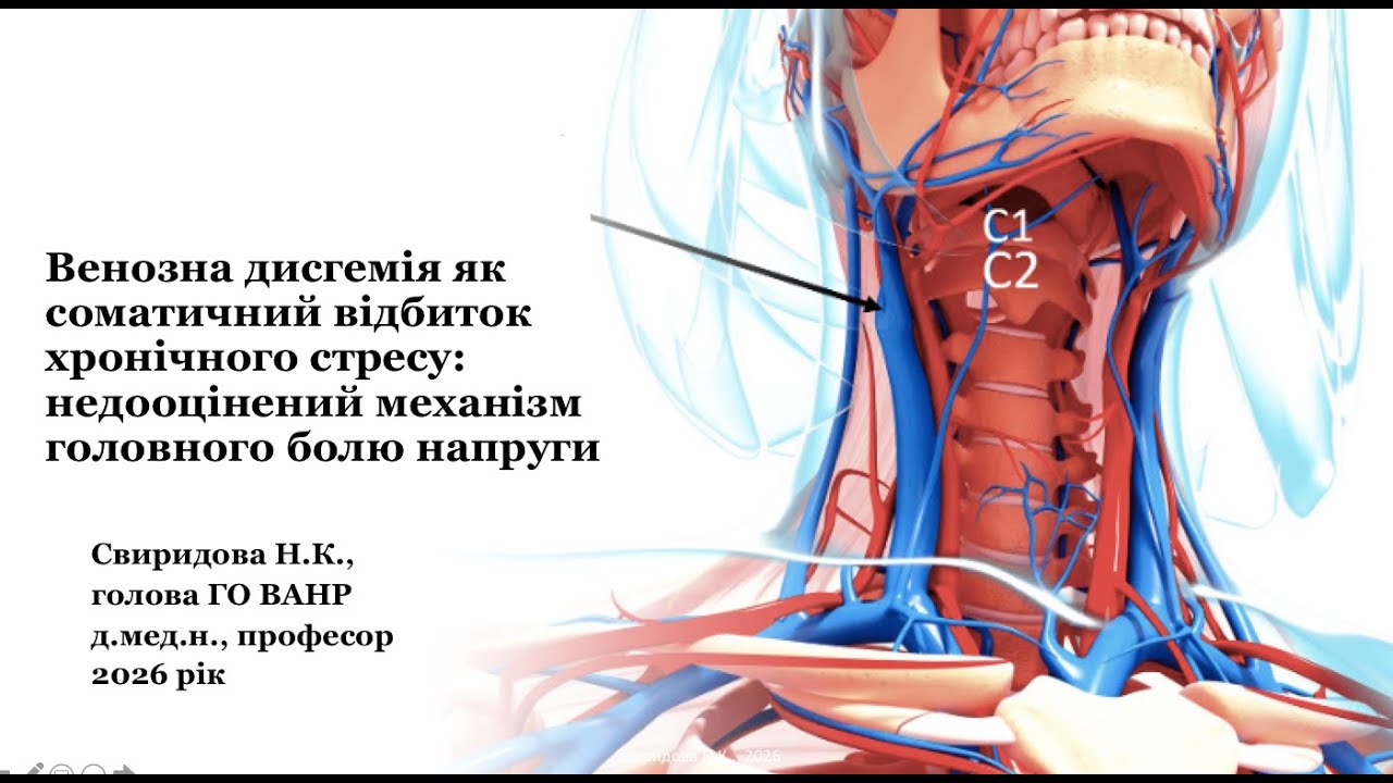 Венозна дисгемія як соматичний відбиток хронічного стресу: як механізм головного болю напруги (2026)