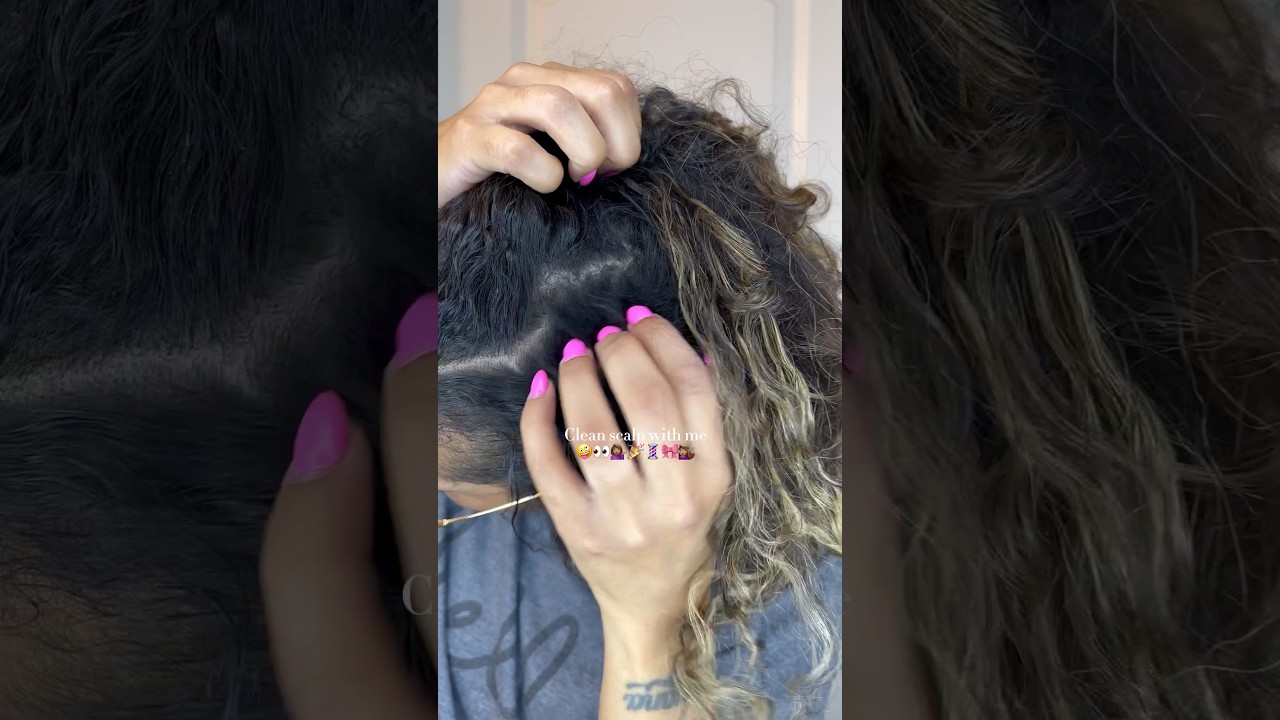 🤪 Dirty itchy scalp | #shortscreator #hair #curls #scalpcare #fyp #shorts #scalp #trending #short