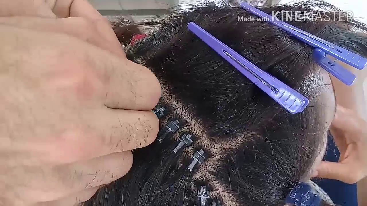Mega-Hair Microlink