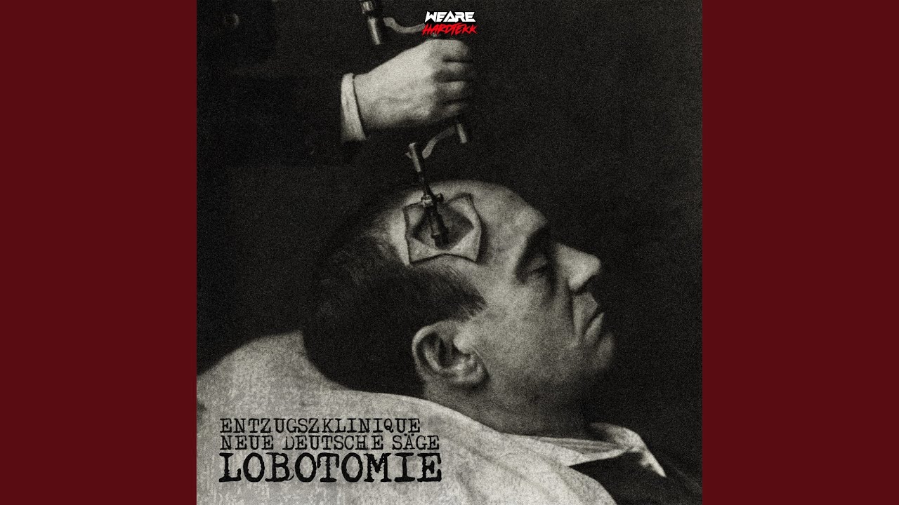 Lobotomie