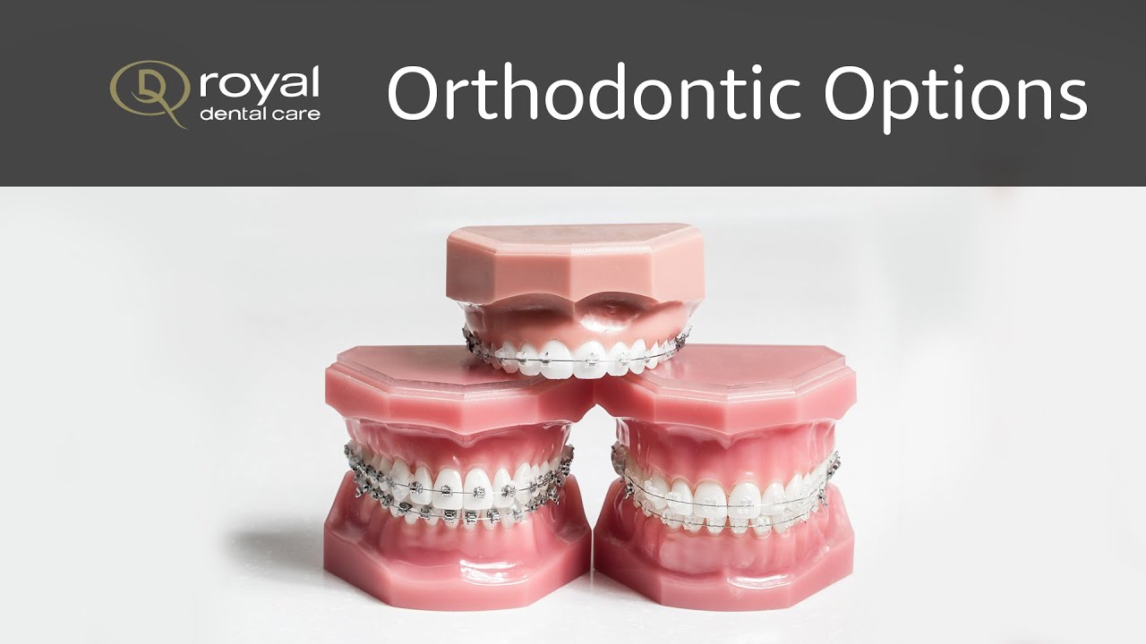 Invisalign, Six Month Smile, or Metal Braces. What's the Best Option For Me?