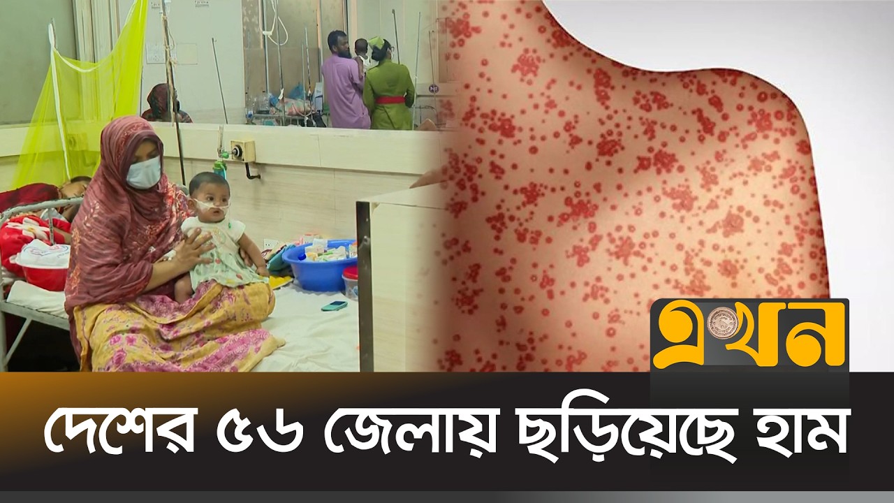 ধেয়ে আসছে হামের ভাইরাস, কীভাবে হবে প্রতিরোধ? | Measles infection Update | Ekhon TV