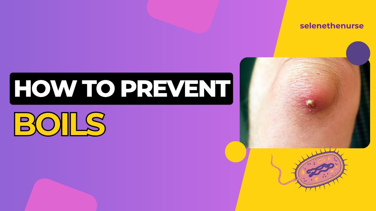 Boils (Furuncles) - causes, symptoms, treatments, care and prevention