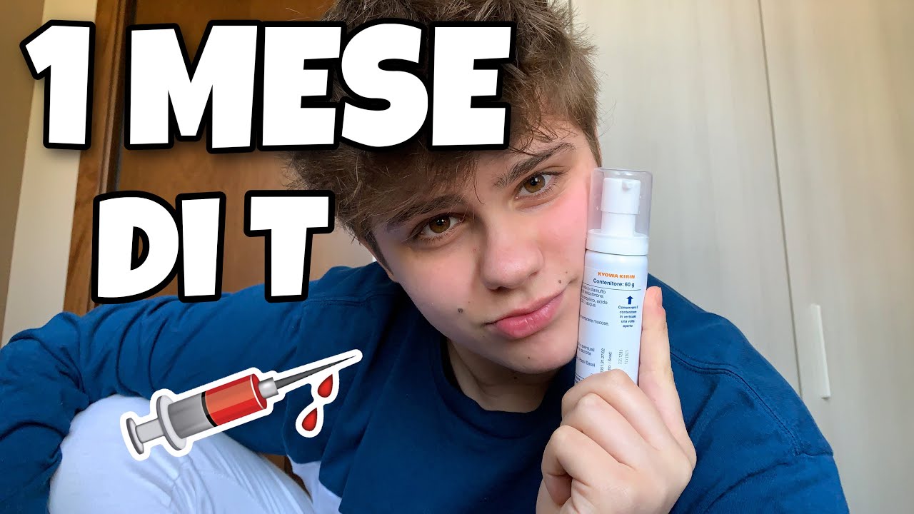 1 MESE DI TESTOSTERONE | Leonardo Santuari