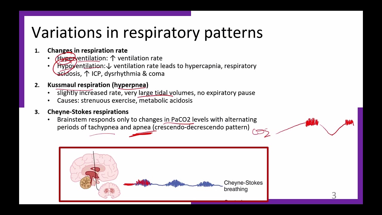 4A General Respiratory disorders