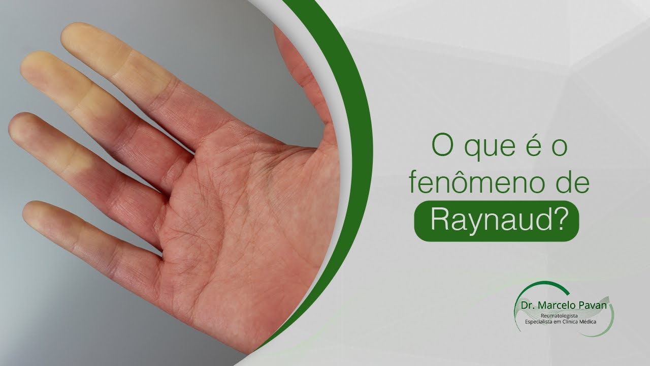 O que é o Fenômeno de Raynaud?