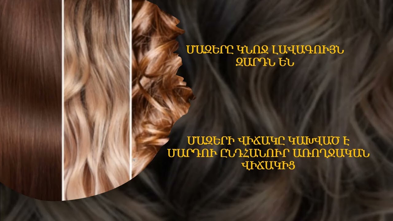 ՄԱԶԵՐԸ ԿՆՈՋ ԼԱՎԱԳՈՒՅՆ ԶԱՐԴՆ ԵՆ