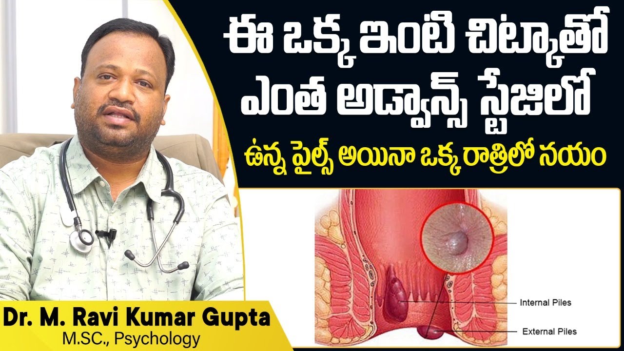 How to Treat Piles Naturally in Telugu | Piles Treatment | Dr Ravi Kumar Gupta | Socialpost Health