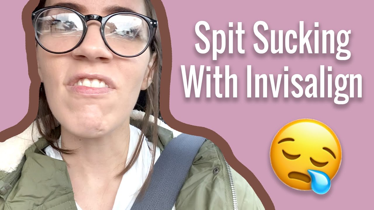 Invisalign Journey - Tray #21