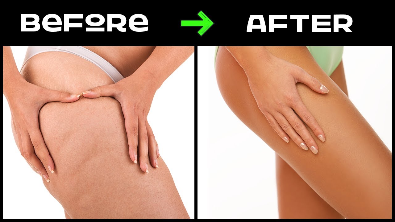 Reduce Cellulite in 2 Weeks! (Workout & Burn Thigh Fat Guide)
