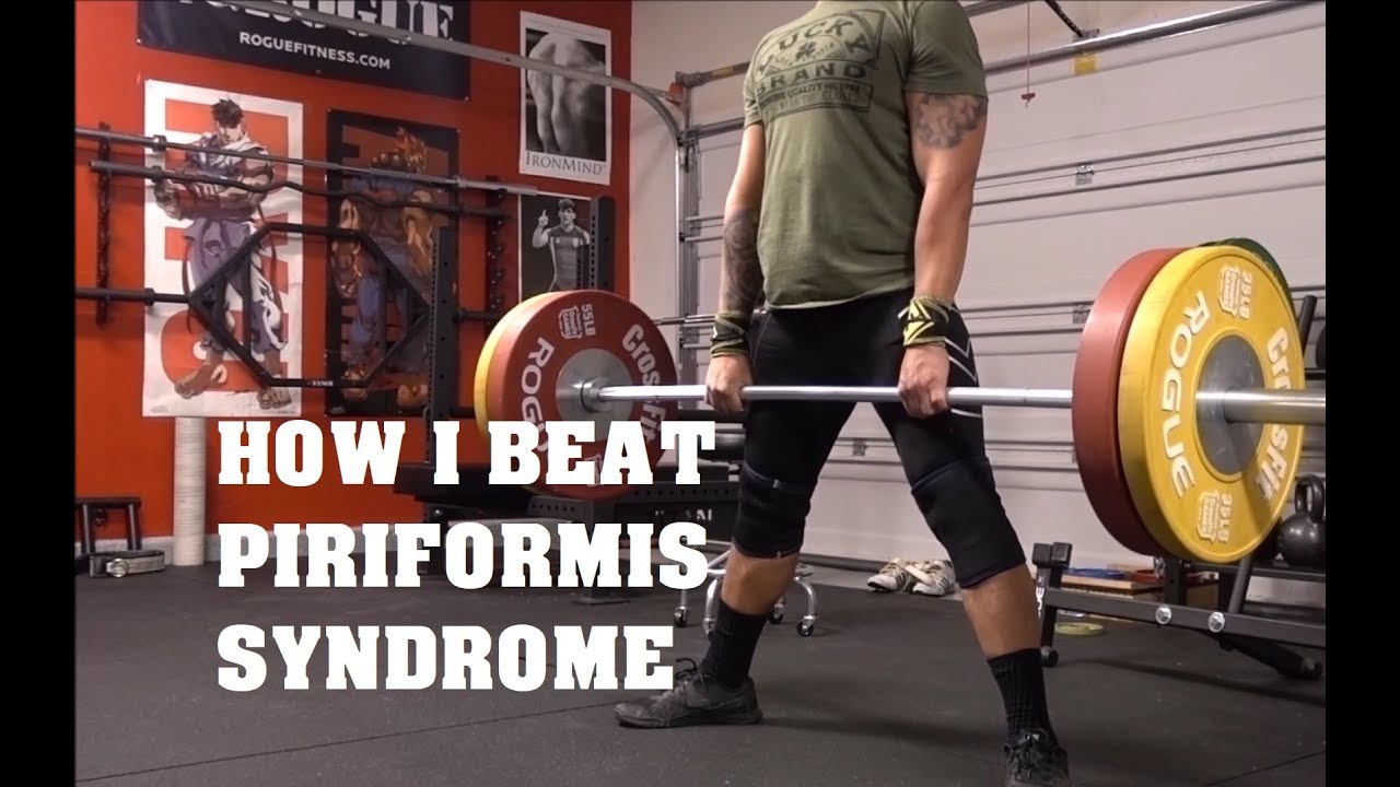 How I Beat Piriformis Syndrome | False Sciatica