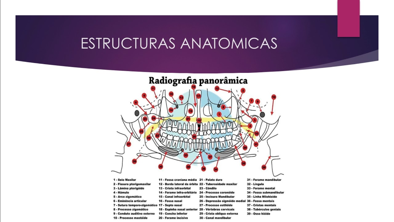 Radiografia panoramica