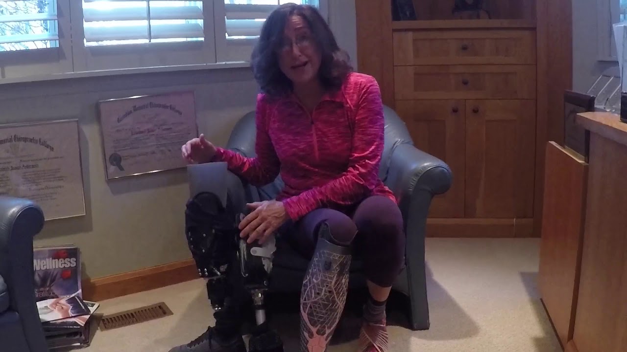 Celebrating one year today of my right below knee amputation.