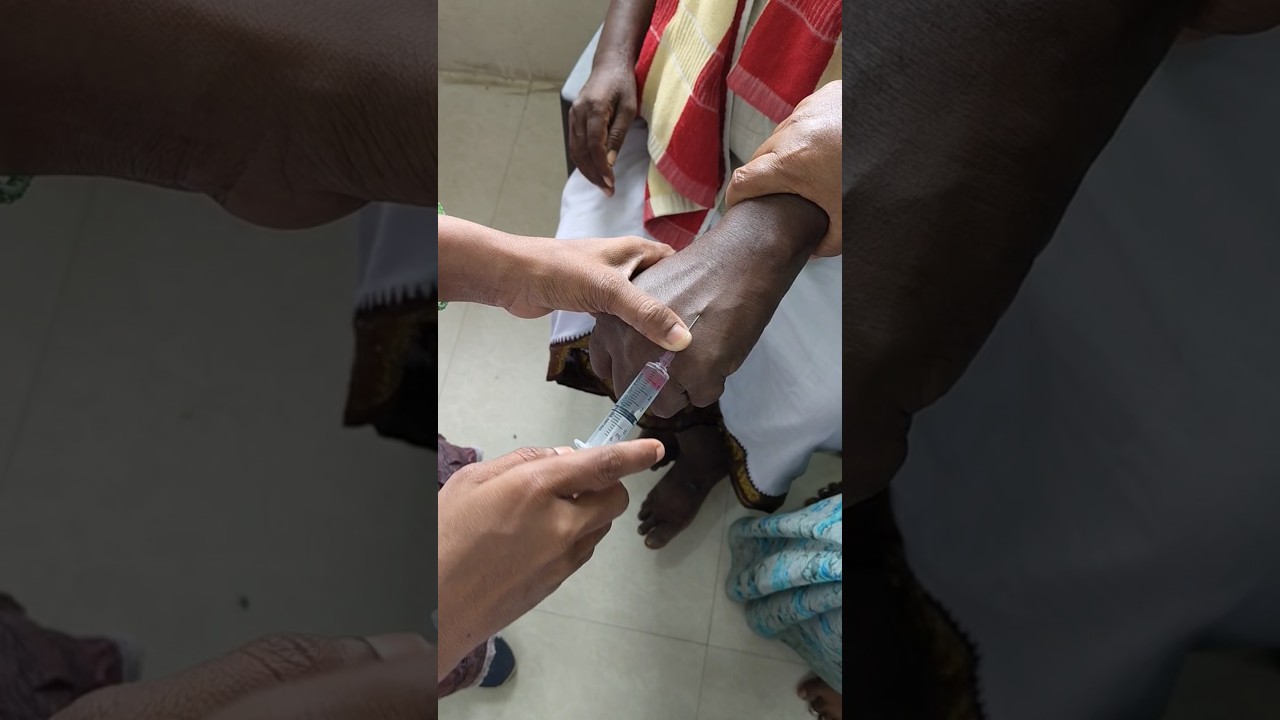 iv injection veyadam ela#direct iv injection#trending#viral#doctor#medical#pharmacy#hospital#nurse