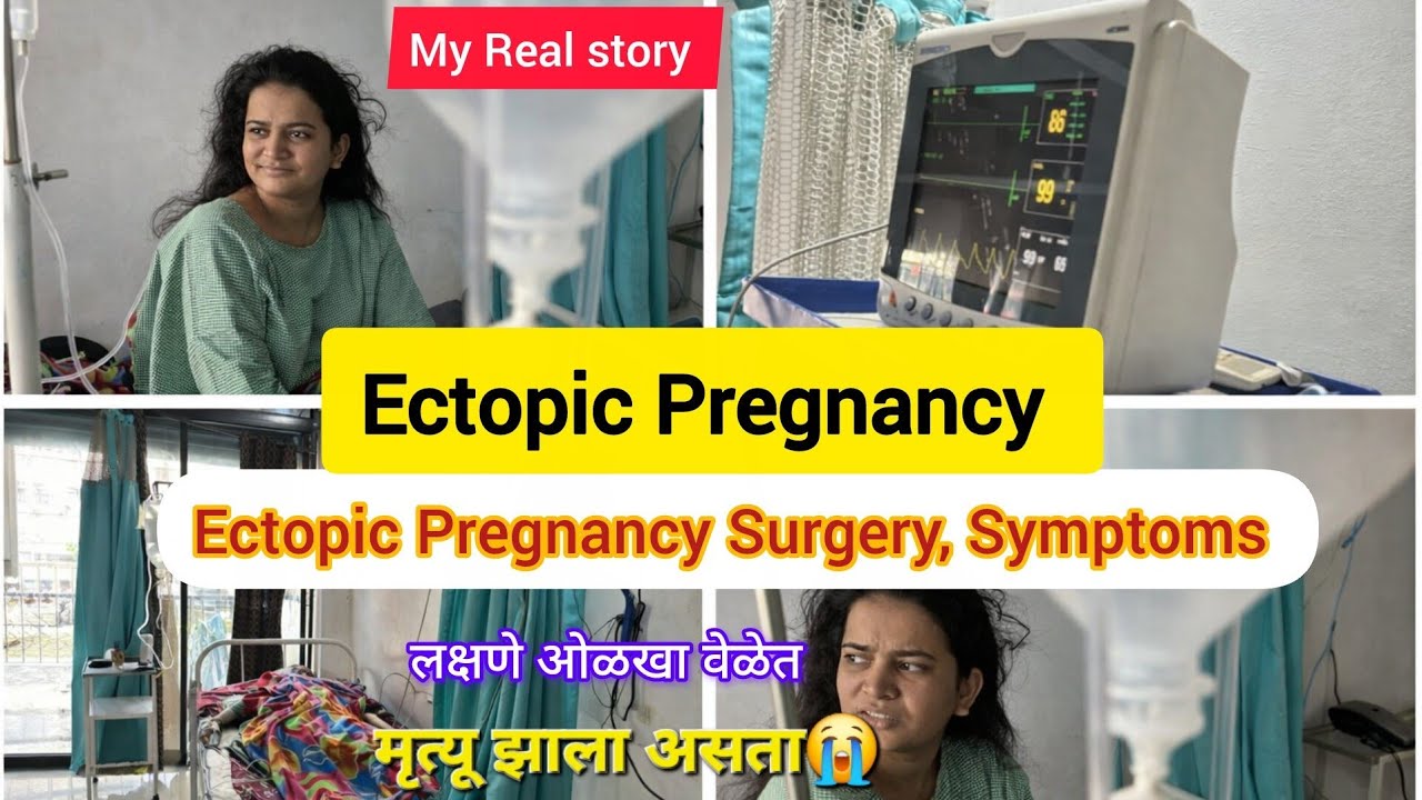 Ectopic Pregnancy म्हणजे काय? Ectopic Pregnancy Symptoms | Ectopic Pregnancy Surgery Real Experience