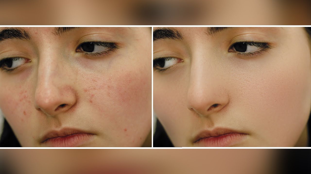 Photoshop: Smooth Skin Retouch  Tutorial | One Shoot Production TV