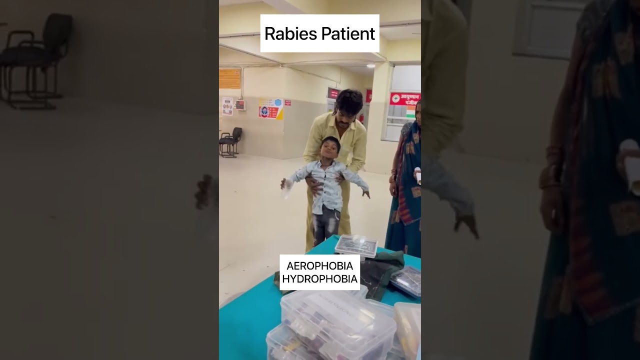 Rabies patient  Aerophobia (Fear of Air) Hydrophobia (Fear of water) #viralyoutubeshorts