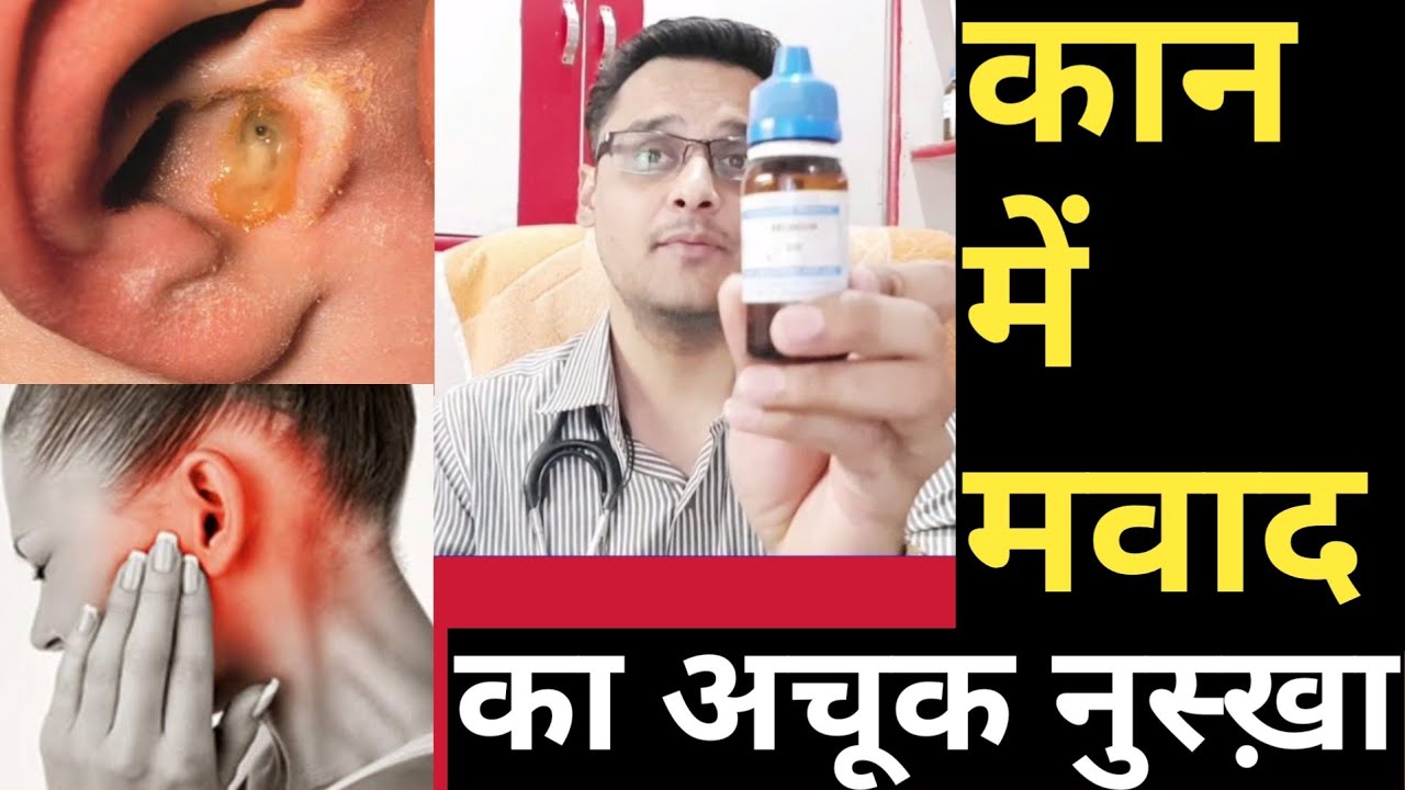 EAR infection treatment/ कान से मवाद बंद करने का सबसे अचूक नुस्खा /otitis media treatment