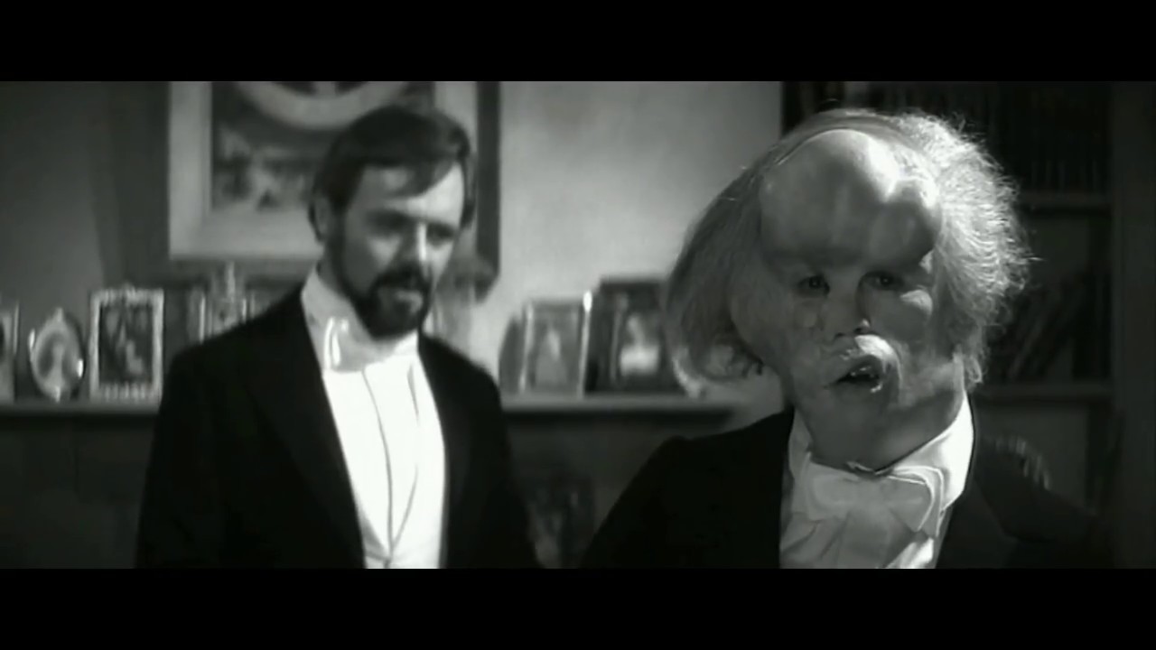 The Elephant Man: 