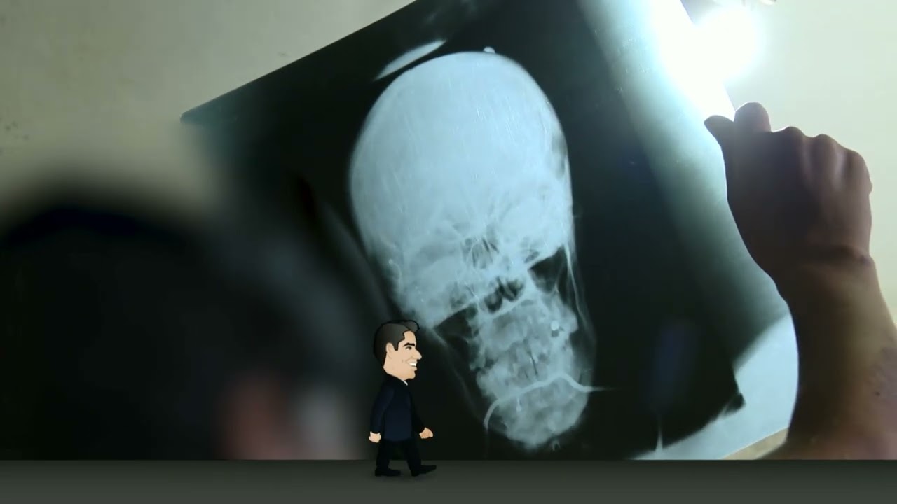Homem é preso por tentar matar a cunhada após festa de Carnaval em Minas Gerais