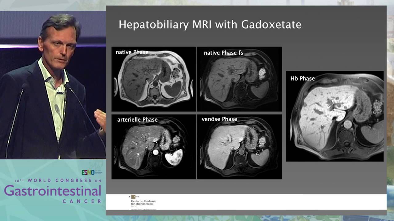 Opening Lecture: Pitfalls in imaging for liver tumors