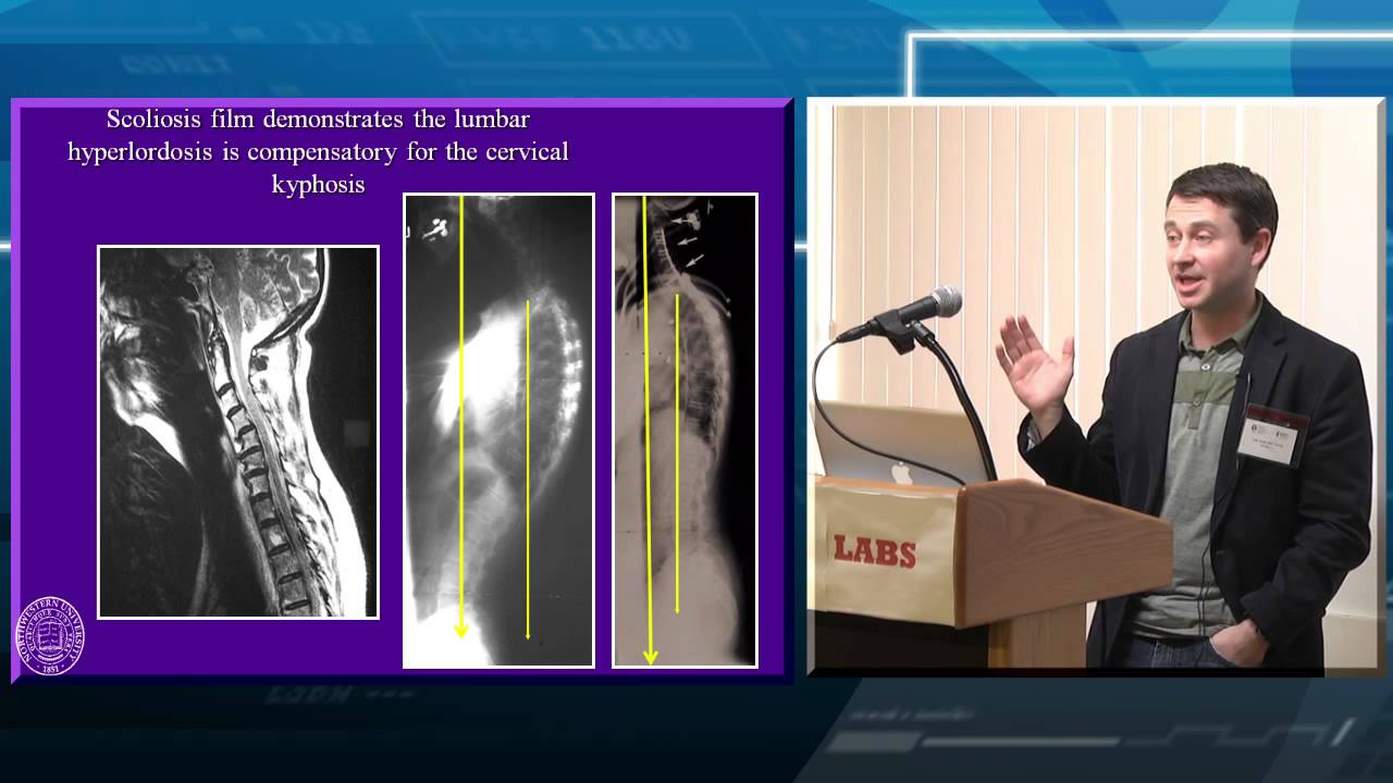 Global Spinal Balance