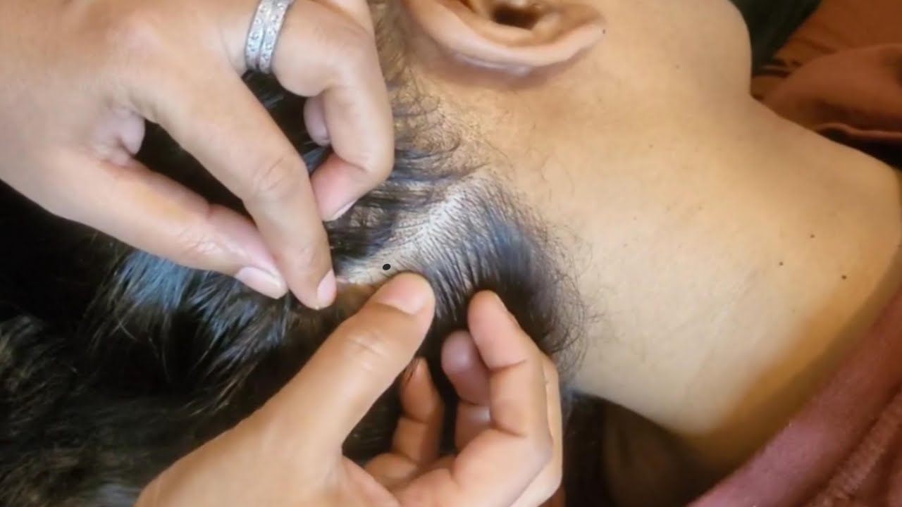 Satisfying Scalp Check ASMR, Soothing Scalp Care & Flake Picking ✨