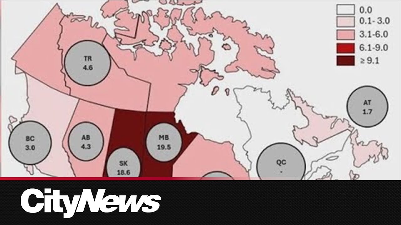 New federal statistics show Manitoba has the highest rate of new HIV cases across Canada