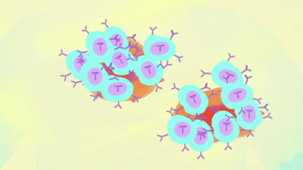 Chimeric Antigen Receptor T-Cell (CAR-T) Therapy