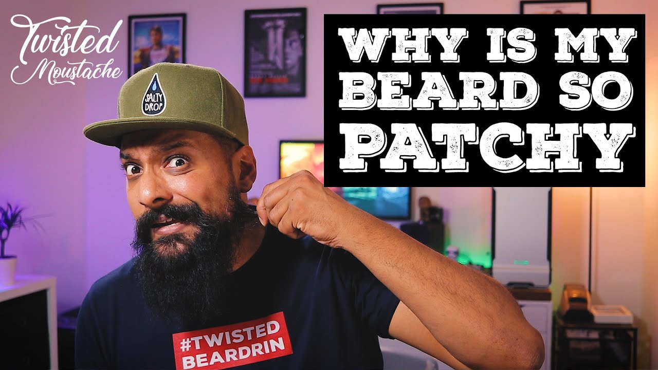 My Beard Is Patchy! How To Deal With Patchy Beard Growth