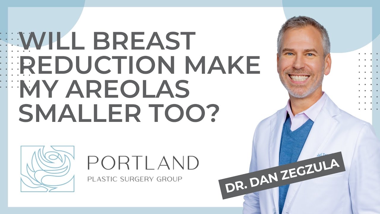 Will breast reduction make my areolas smaller too?