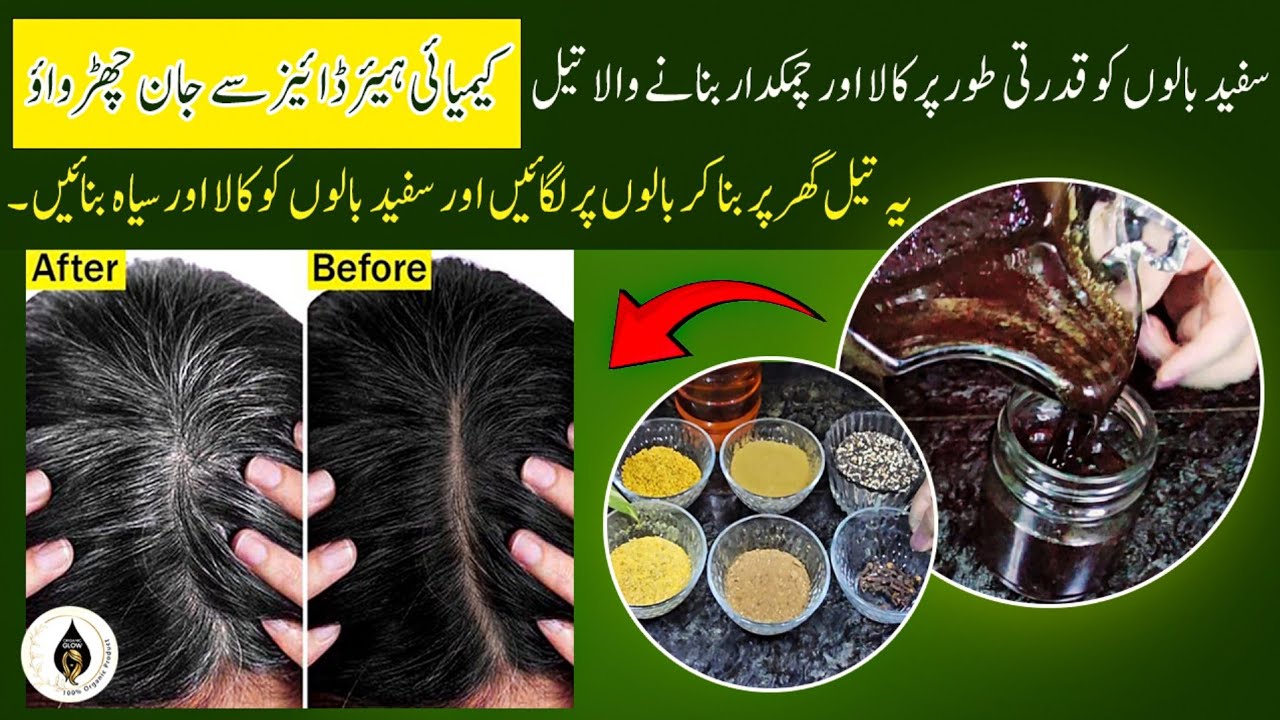 Magical Hair Oil Turn White Hair To Black Naturally | White Hair Problem Solution | Hair Oil