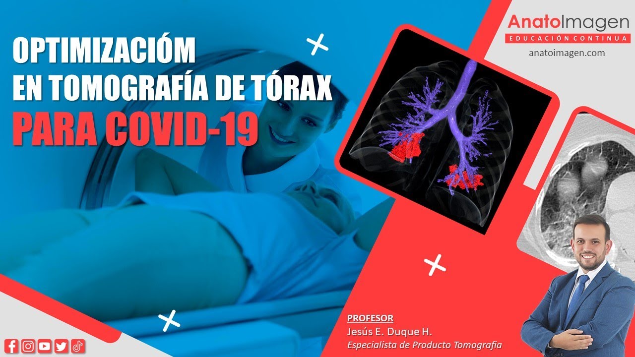 Clase Optimización de Parámetros para Tomografía de Tórax COVID 19