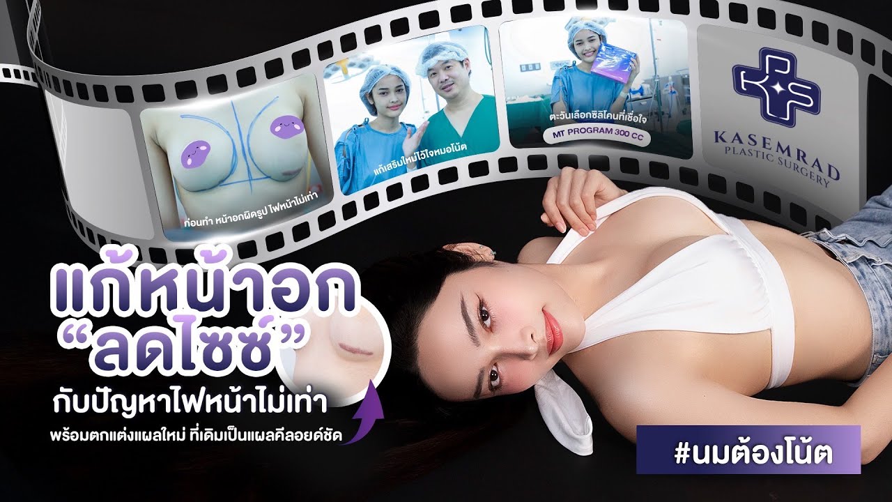 ตะวัน Miss Perfect Thailand 2024 นอยด์แรง ถูกปฏิเสธงาน  จากปัญหาไฟหน้าไม่เท่า แผลคีลอยด์ชัดถึง 7 ซ