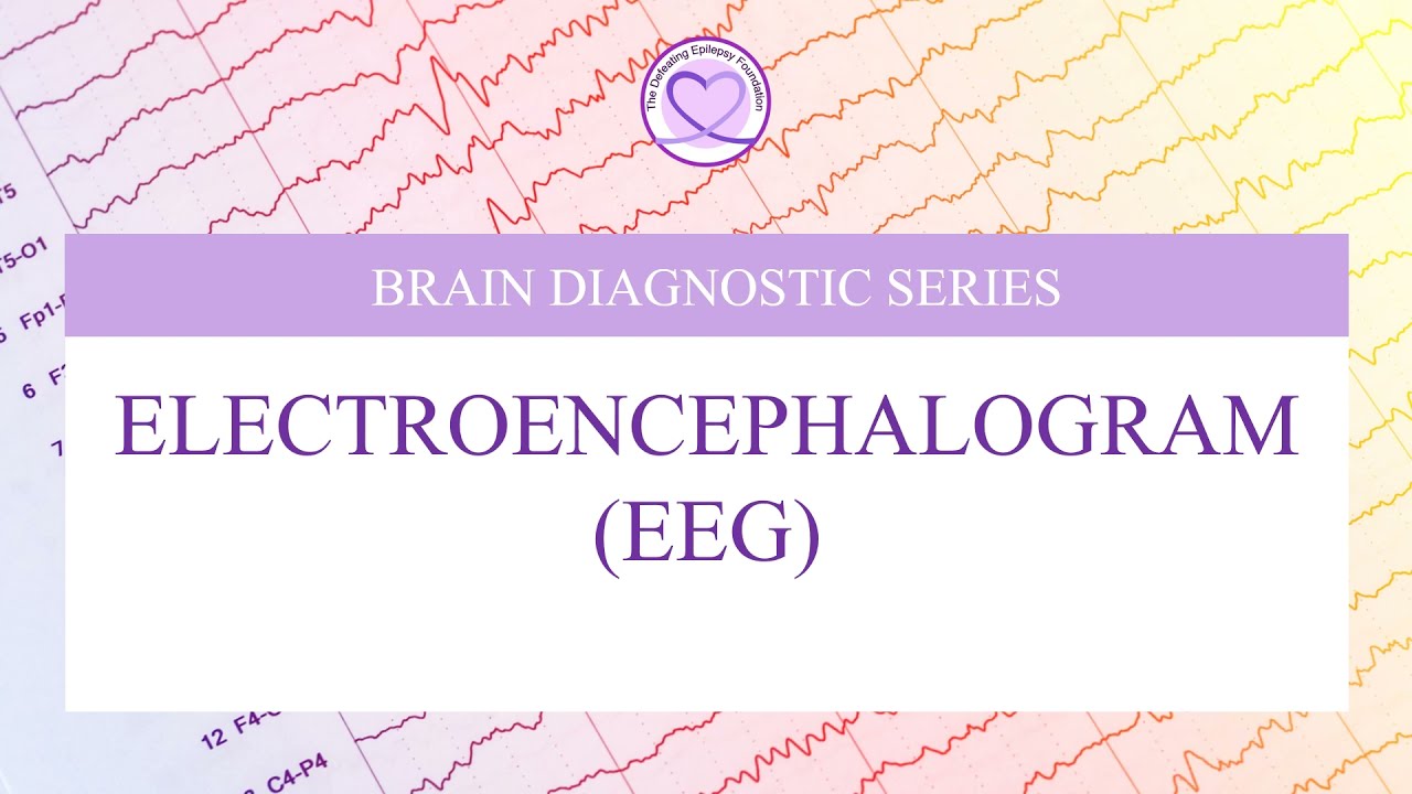What is an Electroencephalogram (EEG)?