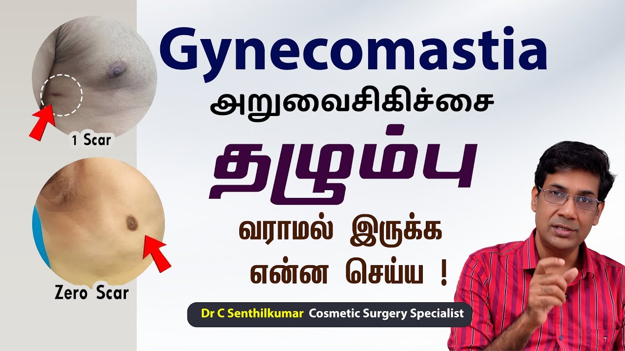 Scars after gynecomastia surgery? ||தழும்பு வராமல் இருக்க | Creas Cosmetic Clinic