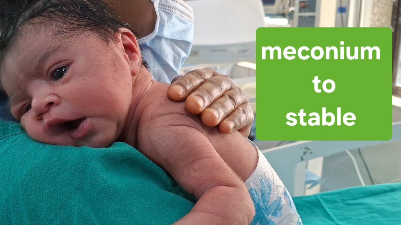 Feeding to meconium baby. 