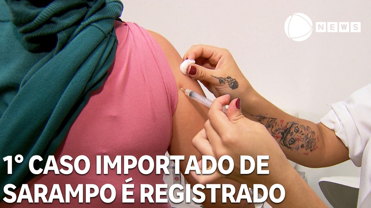 1° caso importado de sarampo é registrado este ano no Brasil