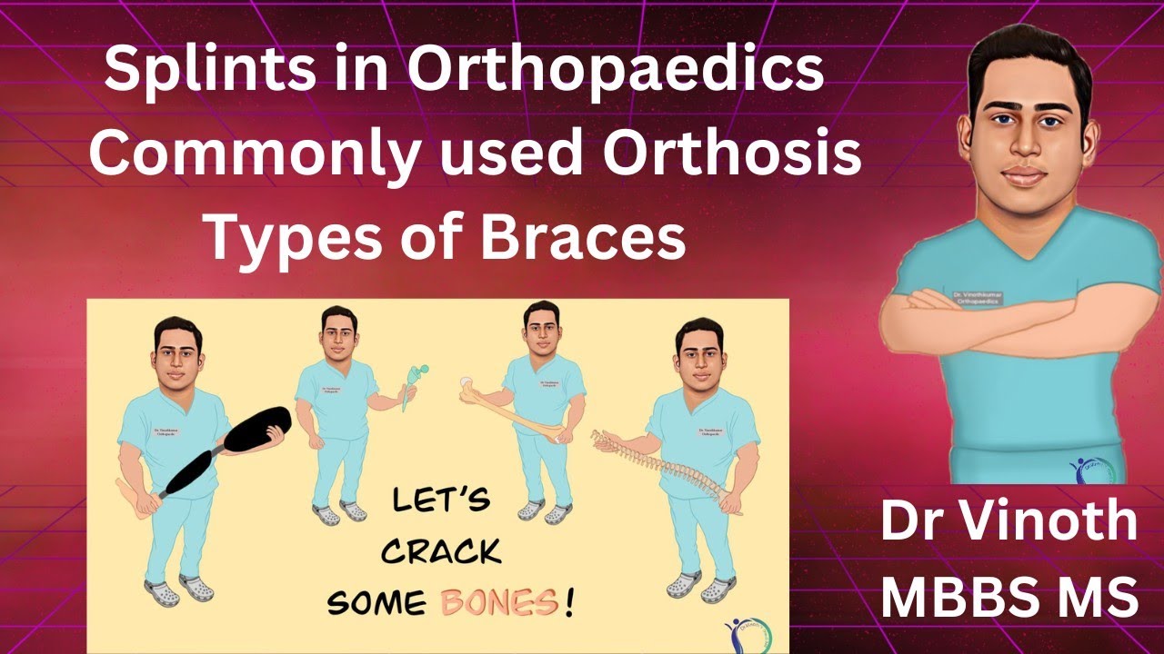 Commonly used Orthosis| Orthotics| Types of Splints in Ortho | Orthopaedic Braces | NEET PG| NExT