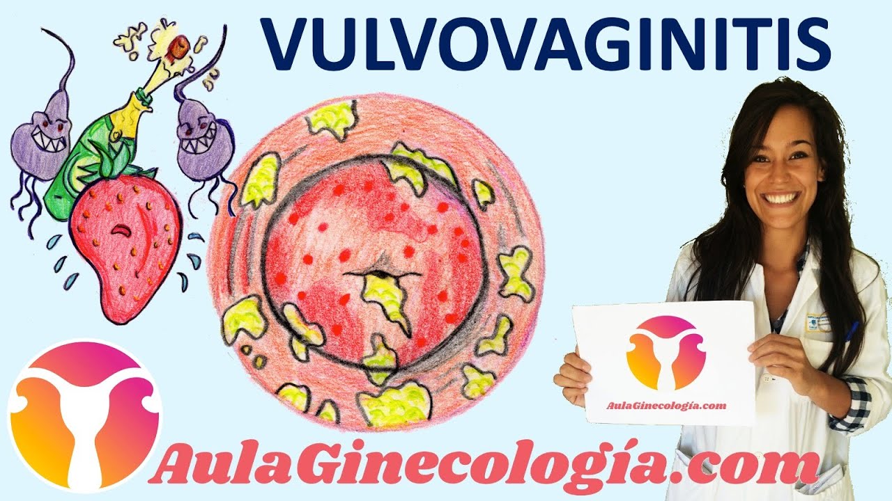 VULVOVAGINITIS: Síntomas, causas, diagnóstico y tratamiento   - Ginecología y Obstetricia -